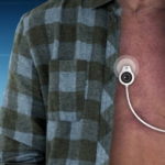 &ldquo;S-Patch Cardio&rdquo; เทคโนโลยีอ่านคลื่นไฟฟ้าหัวใจแบบเรียลไทม์สำหรับผู้ป่วยโรคหัวใจ, Whale Energy Station